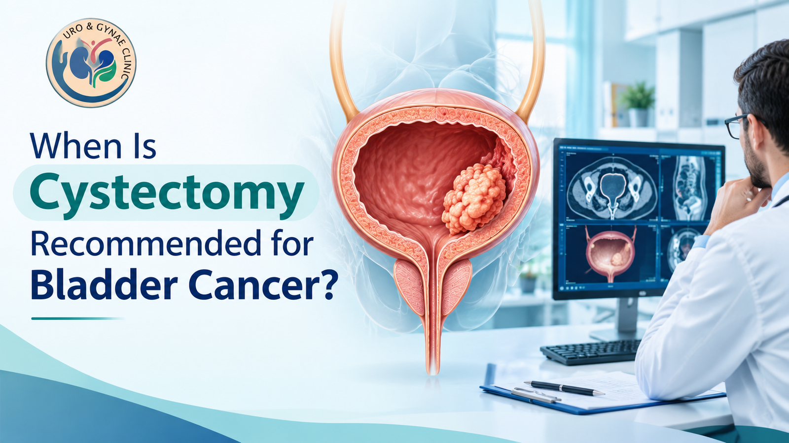 When Is Cystectomy Recommended for Bladder Cancer?